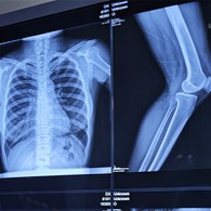 10 Кс 12 Кс- филм